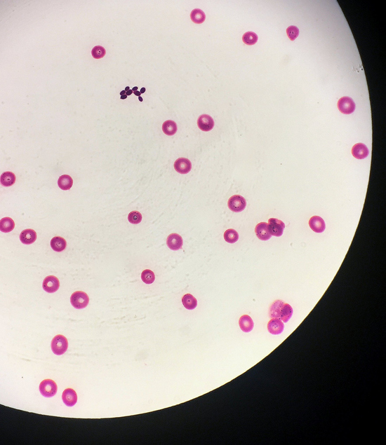 Candida auris - Simplicity Panel™